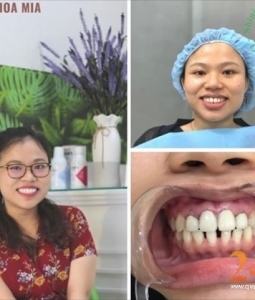 Niềng Răng, Trồng Răng, Chữa Răng Không Đâu Giá Rẻ Uy Tín Tại Quận 11
